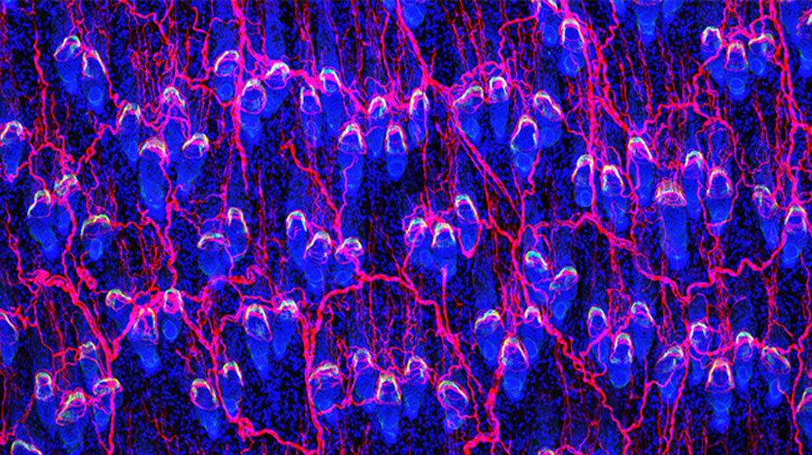Hair follicle cells that guide the connections of the neural network
