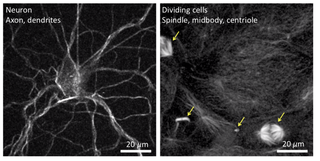 neuron, axon, dendrites