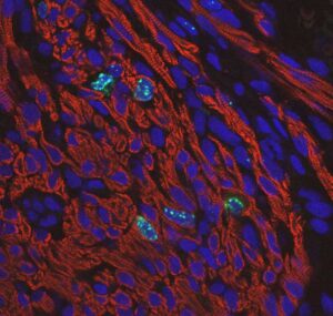 fluorescent staining of cardiomyocyte