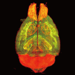 透明化マウス脳全細胞解析