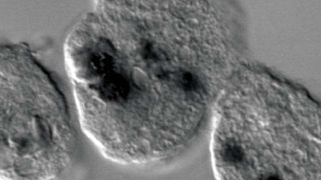 E. histolytica cells