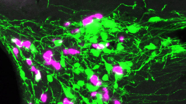 オキシトシンに対する抗体を使い、オキシトシン神経細胞を染め分けた蛍光顕微鏡写真