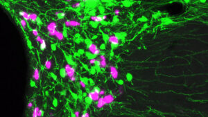 オキシトシン神経細胞（ピンク）