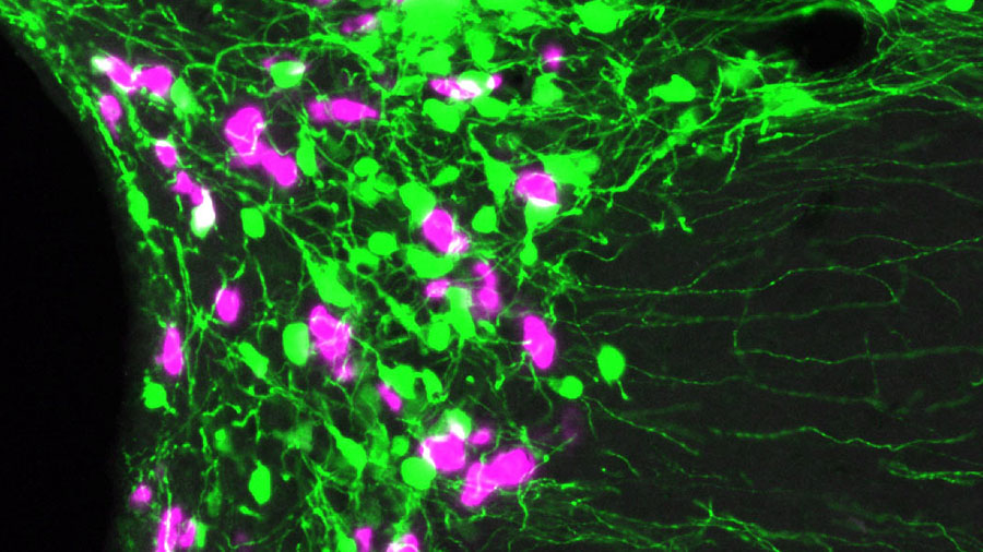 オキシトシン神経細胞（ピンク）
