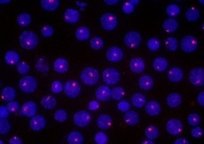 Inactivated X chromosomes in cultured cells from mice, which have been labeled with a fluorescent probe 