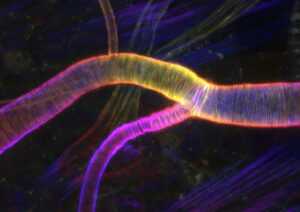 ショウジョウバエの血管を輪っか上に囲むアクチン分子