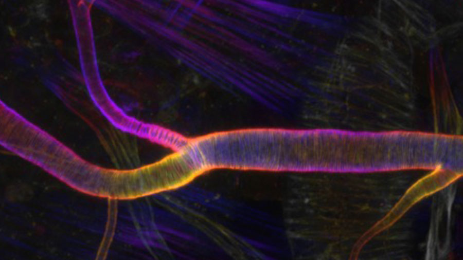 Fluorescent labeling shows the orderly pattern of actin fibers that reinforce channels in the respiratory system of fruit flies.