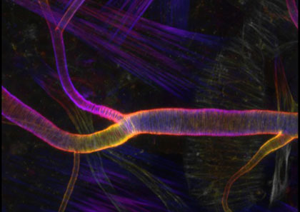 Fluorescent labeling shows the orderly pattern of actin fibers that reinforce channels in the respiratory system of fruit flies.